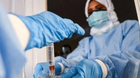 الجزائر في ذيل الدول المشاركة في التجارب الإكلينيكية بـ17%