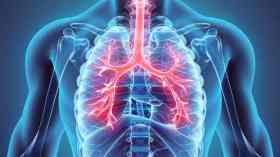 10 أطعمة مهمة جدا لصحة الرئتين.. تعرف عليها