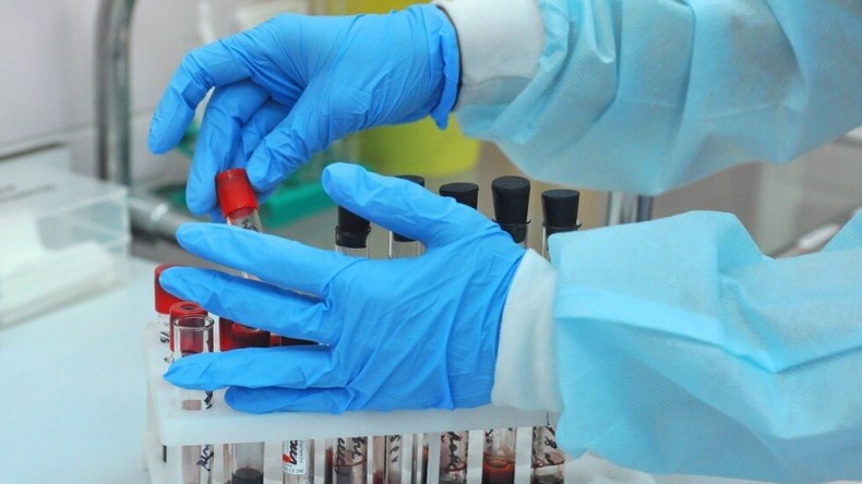 بن باحمد يأمر بضمان وإتاحة الكشوف والتحاليل الخاصة بمرضى كورونا