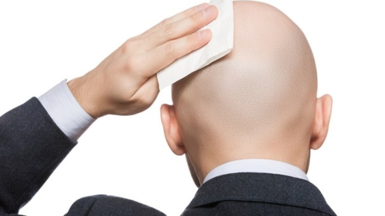 هل الرجل الأصلع حقّا هو الرجل المثالي؟