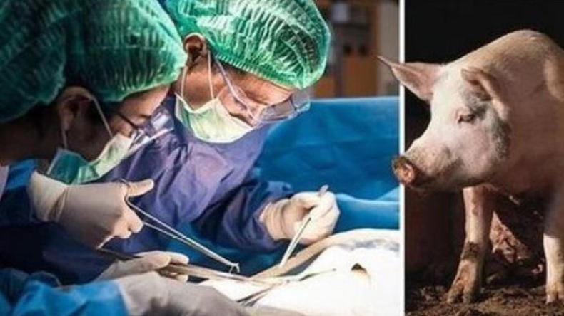 بالفيديو.. هذا ما قاله داعية مصري بشأن نقل كلى الخنزير للإنسان!