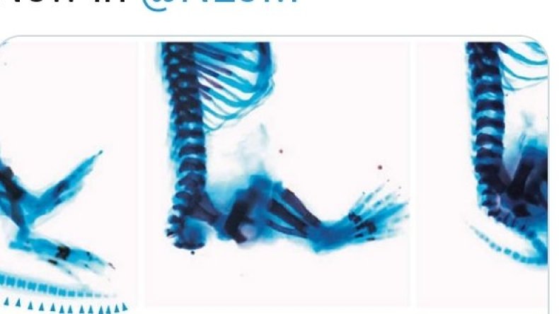 إطلاق اسم باحثة مصرية على مرض وراثي جديد يصيب الأطفال