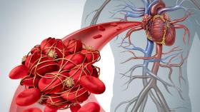 طبيب روسي يحذّر من 3 أغذية ترفع خطر الإصابة بتجلطات الدم 