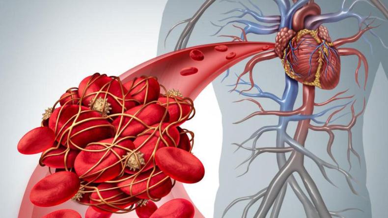 طبيب روسي يحذّر من 3 أغذية ترفع خطر الإصابة بتجلطات الدم 