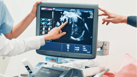 قصة امرأة ينمو جنينها داخل كبدها تحظى بمتابعة قياسية عبر تيك توك!