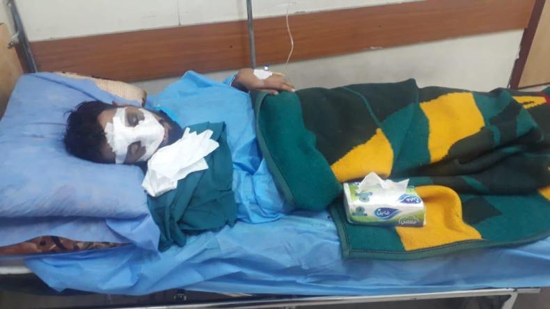 صورة متداولة لرجل عضته زوجته من أنفه بعد اكتشاف خيانته.. هذه قصتها!