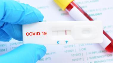 Le Pr Kamel Djenouhat appelle à rendre accessibles les tests antigéniques dans les hôpitaux