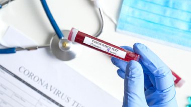 Forged “Corona Virus” Analyzes To Cross At Airports… Medical Teams On The Lookout !