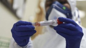 التحاليل الطبية تثير “فتنة” في قطاع الصحة