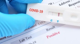 تحاليل “كورونا” مزورة للعبور بالمطارات.. وفرق طبية بالمرصاد