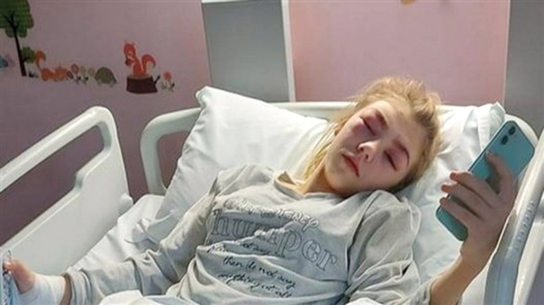 بالصور.. فتاة كادت تفقد بصرها بسبب صبغ حاجبيها ورموشها!