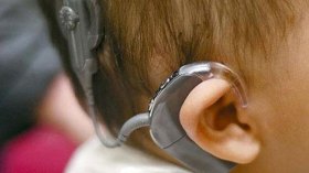 14 ألف طفل أصمّ ينتظرون زرع قوقعة الأذن