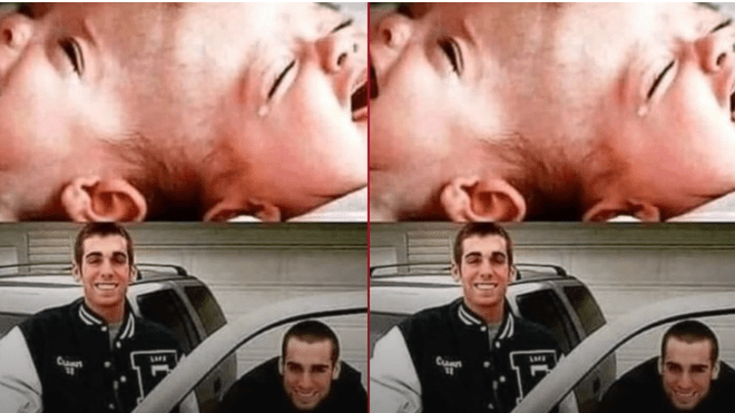 هذه حقيقة الصورة المتداولة لتوأمين ملتصقين قبل وبعد عمليّة فصلهما!