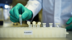 Transmission de maladies mortelles via des oiseaux migrateurs