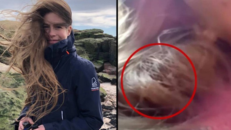 عصفور صغير يعشش في شعر امرأة لمدة 3 أشهر