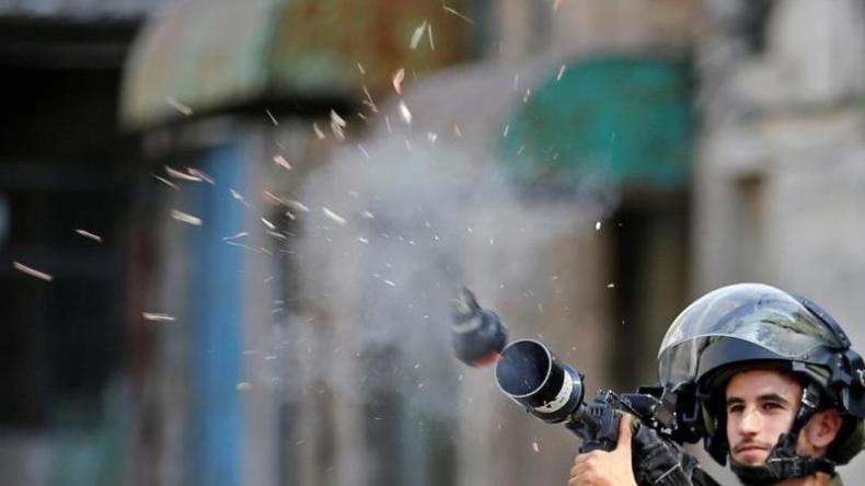 مشاهد مأساوية من فلسطين.. إصابة طفلة بقنبلة صوت في وجهها!