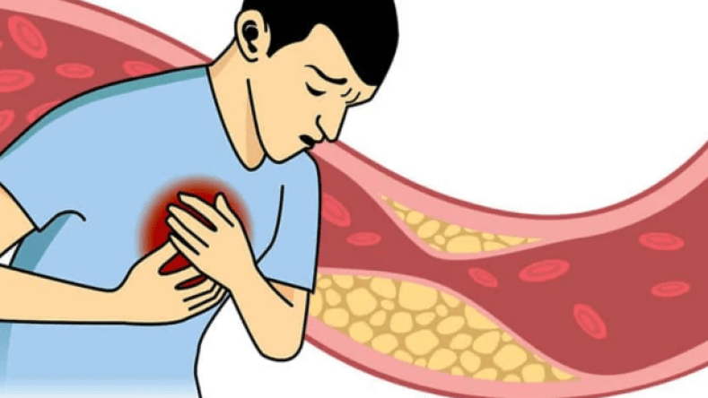 الطرق الـ4 الأكثر فعالية لخفض الكوليستيرول بشكل سريع