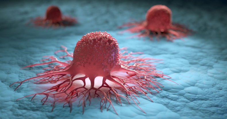 Une première dans l’histoire du cancer: Un anticorps miracle guérit tous les patients