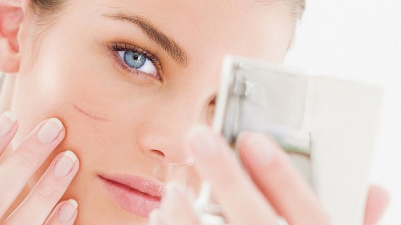 التخلص من آثار الندوب والحبوب.. بين التكنولوجيا والوصفات الطبيعية 