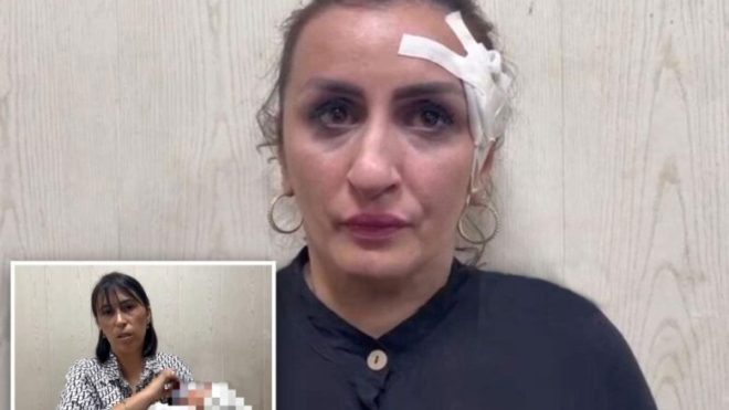 أم تبيع طفلها لإجراء عملية تجميلية لأنفها!