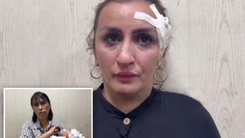 أم تبيع طفلها لإجراء عملية تجميلية لأنفها!