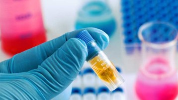 مخابر أم مقابر!؟