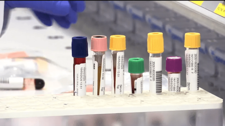 قبل ظهور أي أعراض.. “تحليل دم” بسيط يكشف السرطان  