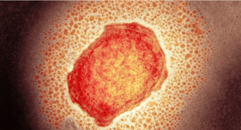 Variole du singe: La Belgique signale un premier décès