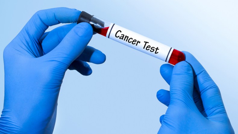نحو 80 بالمائة من تحاليل الكشف عن السرطان غير معوّضة وتتم عند الخواص
