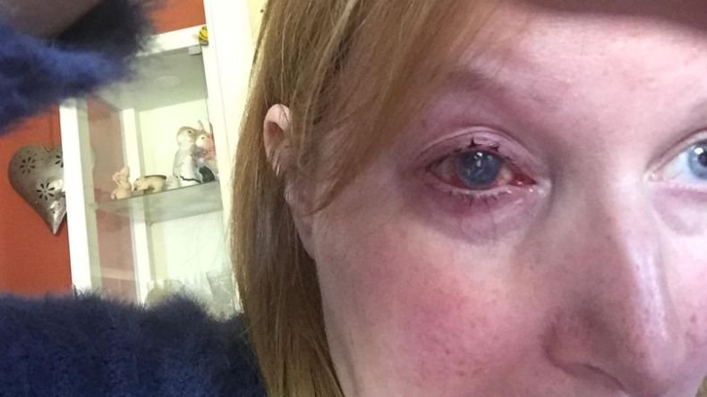 أخصائية عيون تحذّر: هذا التصرف أثناء الاستحمام يجعلك تفقد بصرك!