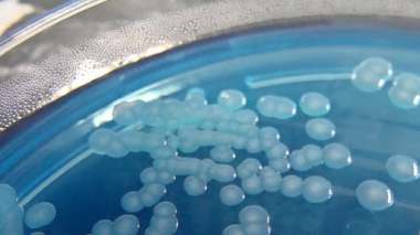 Royaume Uni: Une bactérie tue huit enfants