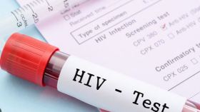 هذا هو عدد الإصابات بالسيدا في الجزائر