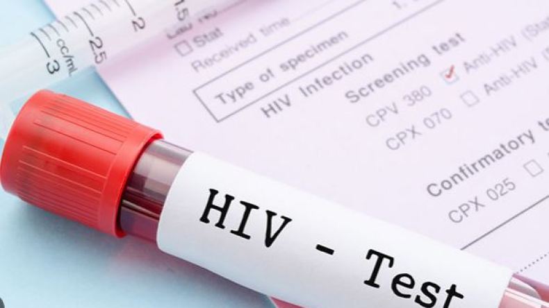 هذا هو عدد الإصابات بالسيدا في الجزائر