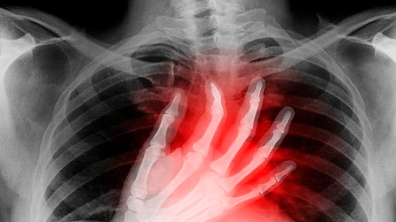 طبيب روسي يحذّر: الحزن والإجهاد الشديد قد يسبّبان الوفاة