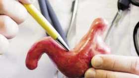 هذه مضاعفات ومخاطر عمليات تكميم المعدة وشفط الدهون