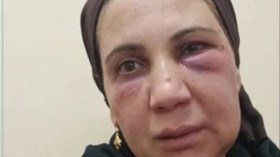 زوج مصري يعتدي على زوجته بالضرب لأنها طبقت نصيحة ياسمين عز