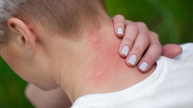 مركز يقظة حدودي للحد من انتشار الملاريا في الجزائر