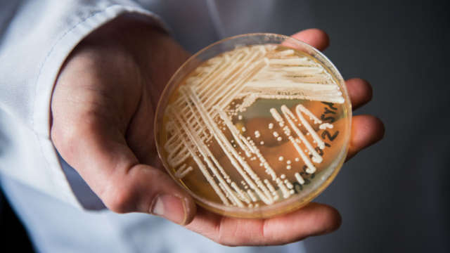 États-Unis: Un champignon mortel se développant à toute vitesse,se répand