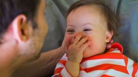 أطفال “تريزوميا 21”.. ضحايا عدم التقبل!