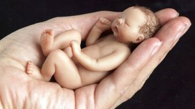 بالفيديو.. توأم بحجم كف اليد يدخل موسوعة غينيس