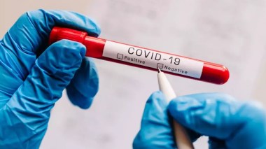 Coronavirus: Quatre (4) nouveaux cas et aucun décès ces dernières 24h en Algérie