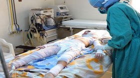 300 حادث و7 وفيات.. حصيلة قياسية لحروق الأطفال