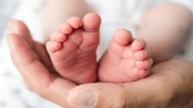 ولادة طفل عراقي بحالة طبية نادرة الحدوث (صورة)