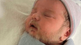 هذه حقيقة الصورة المتداولة لرضيع بلحية بيضاء!