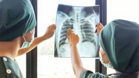 انتشار سرطان العظام وسط الأطفال والشباب