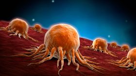 كيف نقلل خطر الإصابة بالسرطان؟.. طبيب أورام يكشف عن تدابير الوقاية