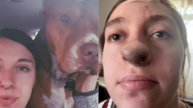 Une Américaine éprouve des complications étranges après avoir été mordue par un chien