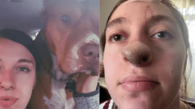 Une Américaine éprouve des complications étranges après avoir été mordue par un chien