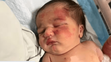 Liban: Un bébé abandonné dans un sac-poubelle découvert dans la gueule d’un chien errant