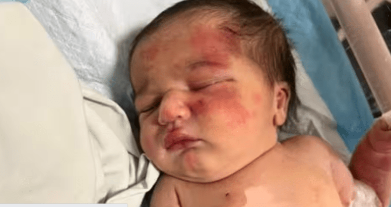 Liban: Un bébé abandonné dans un sac-poubelle découvert dans la gueule d’un chien errant